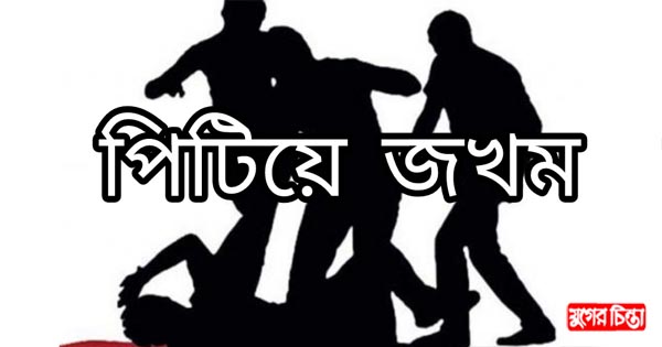 বন্দরে বৃদ্ধাকে&nbsp;পিটিয়ে জখম