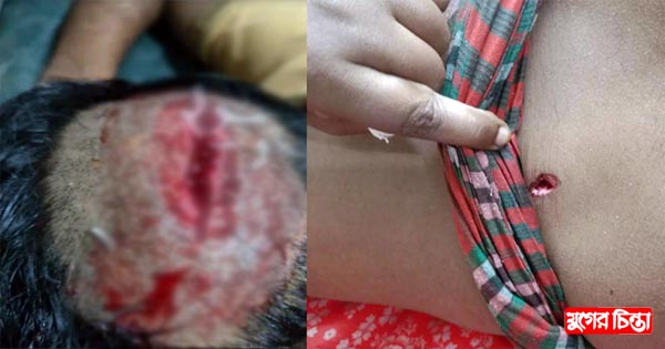 চনপাড়ায় দুই গ্রুপের সংঘর্ষে গুলিবিদ্ধসহ আহত-১০