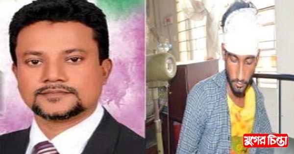 আমার জনপ্রিয়তায় ঈর্ষান্বিত হয়ে কর্মীদের উপর হামলা : মাসুম &nbsp;