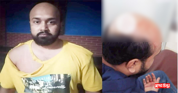 সোনারগাঁয়ে&nbsp;প্রবাসীকে মারধর&nbsp;ও চাঁদাবাজি মামলায় ফাঁসানোর অভিযোগ
