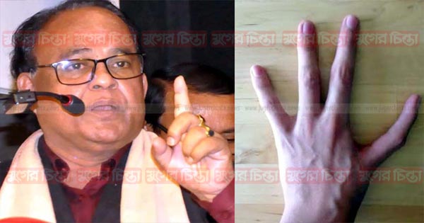 অকল্যাণকর আঙুল কেটে ফেলার পরামর্শ এড. মাসুমের