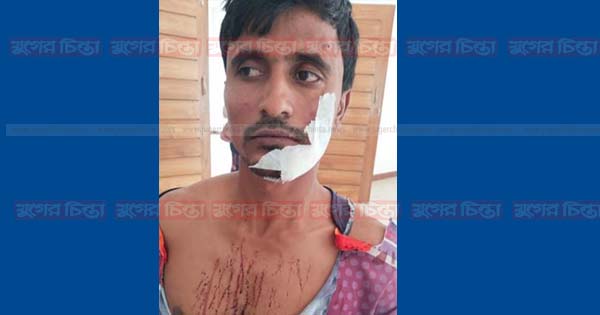 সহকর্মীর অস্ত্রাঘাতে দিনমজুর জখম