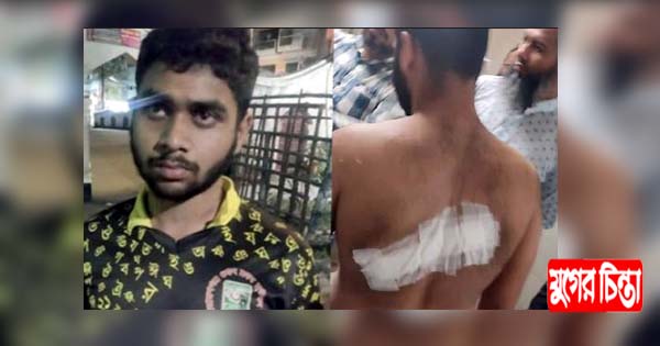 শিশু শিল্পী অনন্ত&rsquo;র উপর হামলার ঘটনায় চার্জশীট দাখিল