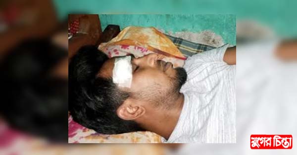 সিদ্ধিরগঞ্জে যুবলীগ কর্মীর উপর সন্ত্রাসী  সজু বাহিনীর হামলা