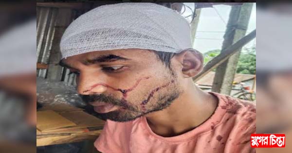 স্ত্রীর দায়ের কোপে স্বামী আহত