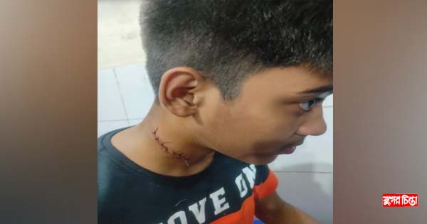 সোনারগাঁওয়ে স্কুলছাত্রকে হত্যার চেষ্টা কিশোর গ্যাংয়ের
