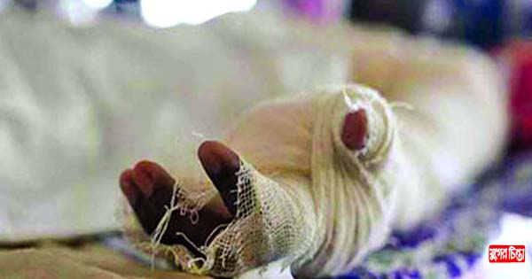 রূপগঞ্জে কেমিক্যাল কারখানায় আগুনে দগ্ধ আরও একজনের মৃত্যু