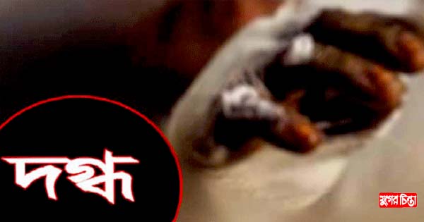 রূপগঞ্জে বসত ঘরে আগুন, স্বামী-স্ত্রী দগ্ধ