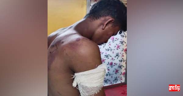 মোবাইল ফোনে ডেকে নিয়ে যুবককে পিটিয়ে জখম