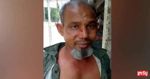 বন্দরে পুত্রের লাঠির &nbsp;আঘাতে পিতা আহত