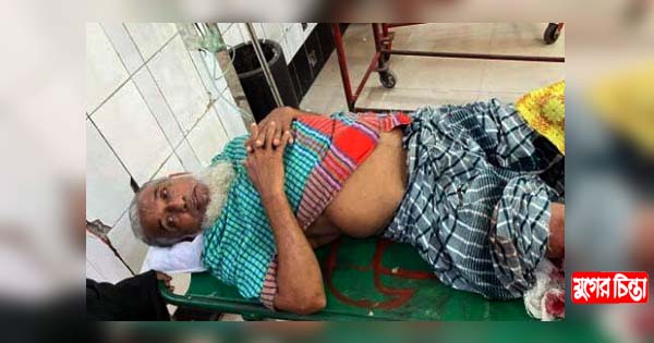 সোনারগাঁয়ে সাবেক ইউপি চেয়ারম্যানের ভাইকে কুপিয়ে জখম