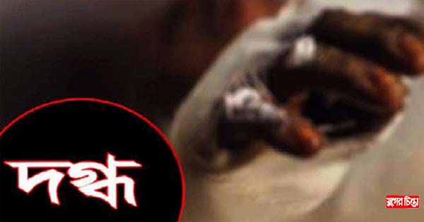 আড়াইহাজারে পিকআপে আগুন, হেলপার দগ্ধ