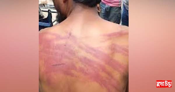 বন্দরে চোর অ্যাখ্যা দিয়ে গাছে বেঁধে প্রতিবন্ধী নির্যাতন