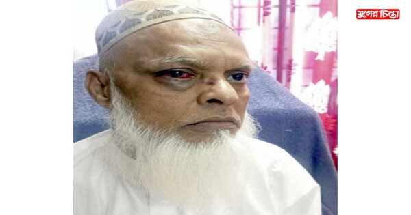 ফতুল্লা থানা বিএনপি`র সেক্রেটারি আইনজীবী বারী ভূঁইয়ার উপর হামলা
