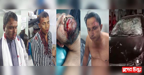 রূপগঞ্জে যুবলীগের দুইপক্ষের হামলায় আহত-৮