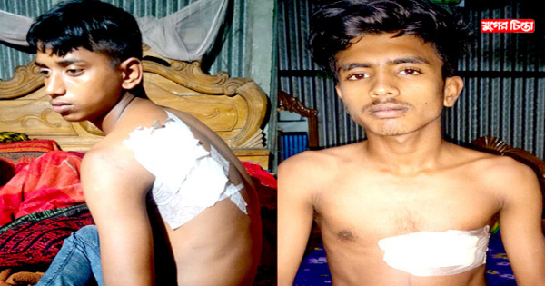 ফেসবুকে হাহা রিয়েক্ট দেয়ায় সোনারগাঁয়ে দুই জনকে কুপিয়ে জখম