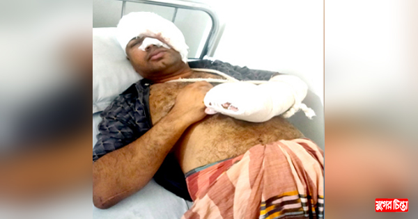 চাঁদার টাকা না পেয়ে ইউপি সদস্যকে কুপিয়ে জখম