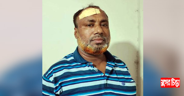 স্ত্রীর ভাড়াটে সন্ত্রাসীদের হামলায় প্রবাসী স্বামী আহত