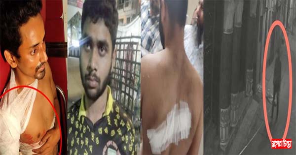 সাংবাদিকরা কেন টার্গেটে?