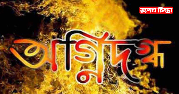 গ্যাস লিকেজ থেকে আগুন,দগ্ধ একই পরিবারের ৪ জন