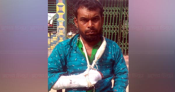 আড়াইহাজারে আঙ্গুল বিচ্ছিন্ন করার  মামলা না নিয়ে উল্টো মামলা