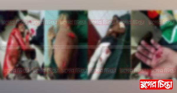 আড়াইহাজারে ওয়াজ মাহফিলে ৫ কিশোরকে কুপিয়ে জখম