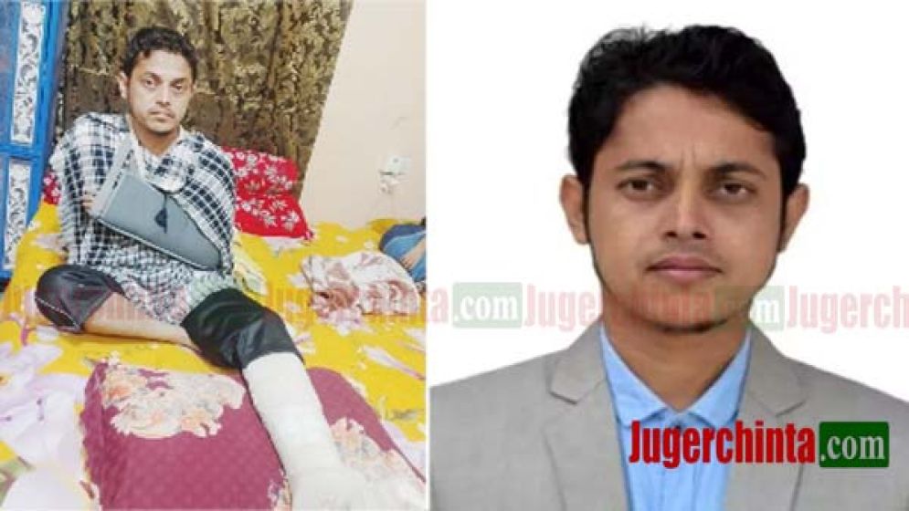 সড়ক দুর্ঘটনায় যুগের চিন্তার সাংবাদিক রাকিব গুরুতর আহত, দোয়া প্রার্থনা