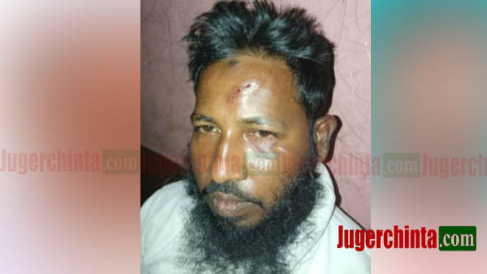 ফতুল্লায় জামায়াত নেতার  উপর হামলার অভিযোগ